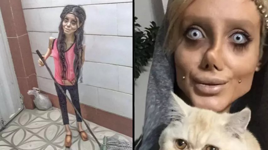 'Zombie Girl' Who Wanted To Look Like Angelina Jolie Actually Looks Like This