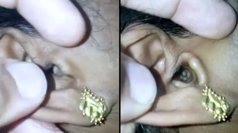 Woman Falls Asleep Outside And Wakes Up With Spider Living In Her Ear