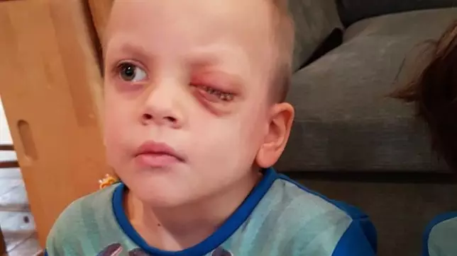 Boy Has Eye Removed Over Christmas After Mum Finds Rare Cancer In Photo
