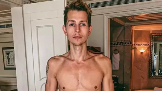 James McVey Says He'll Confront Relationship With Food Following I'm A Celebrity