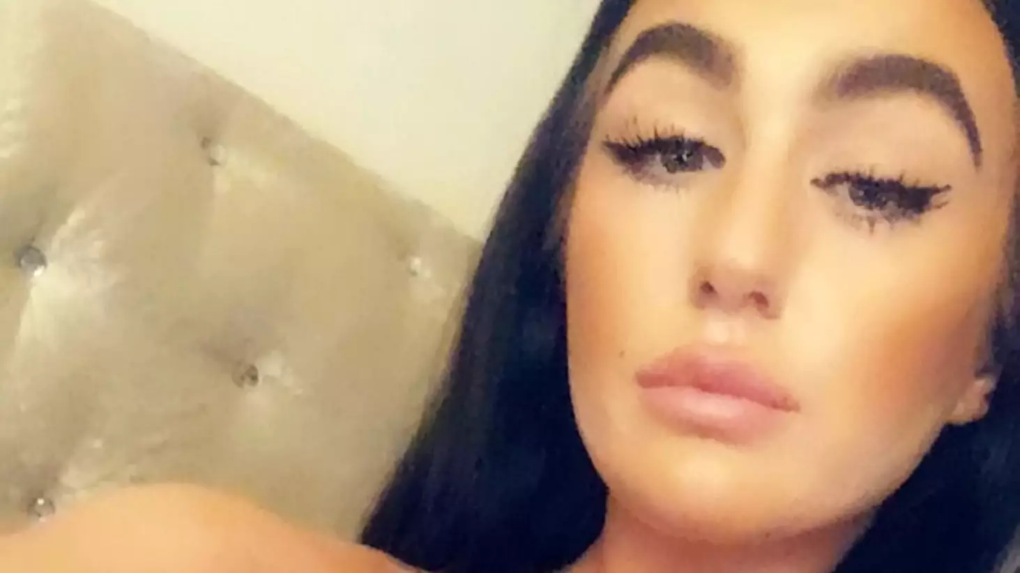 ​Woman Given Wonky Breasts Two Cup Sizes Apart After Botched Surgery In Turkey