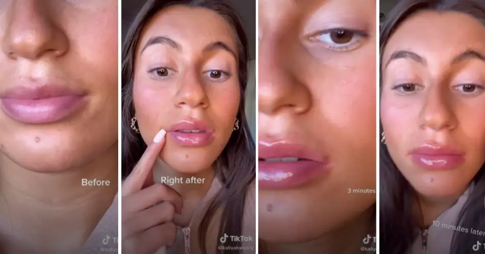 TikTok users are sharing their experiences with the Derol lip plumper (