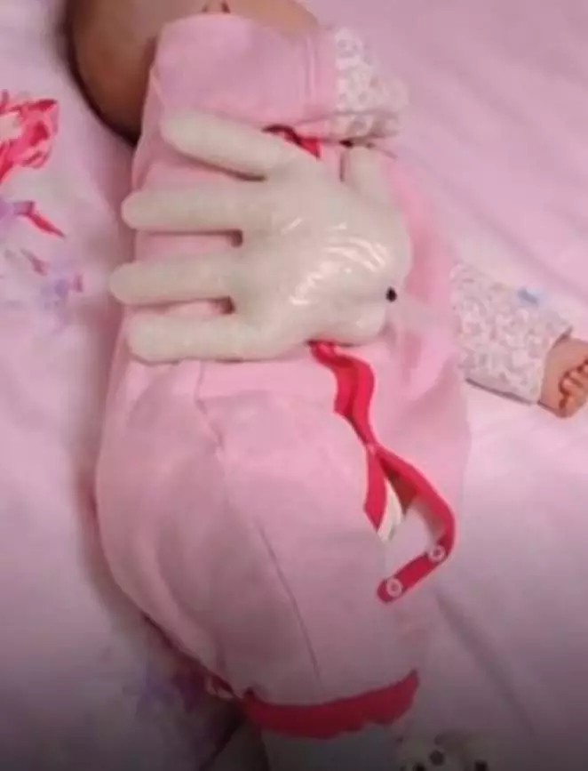 This picture shows a weighted glove on the baby.