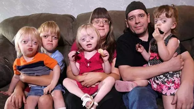 Mother Slams Vile Meme Mocking Kids Who Suffer From Rare Condition