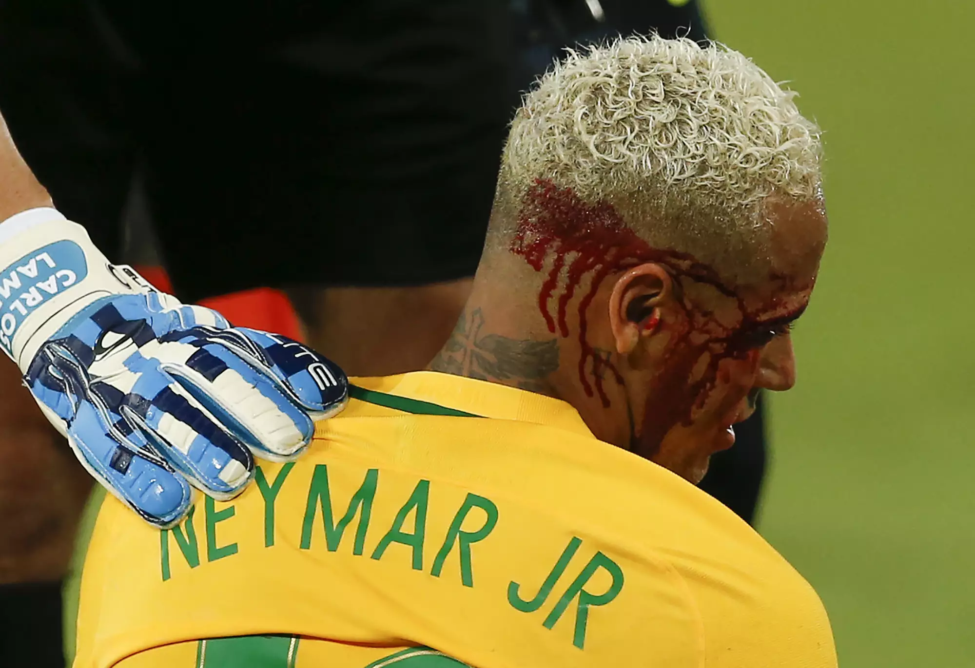 Bolivia's Yasmani Duk Explains His Rough Treatment Of Neymar