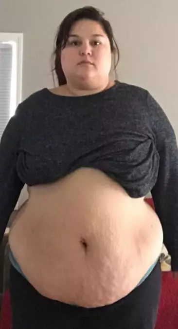 Nicole before her incredible weight loss.
