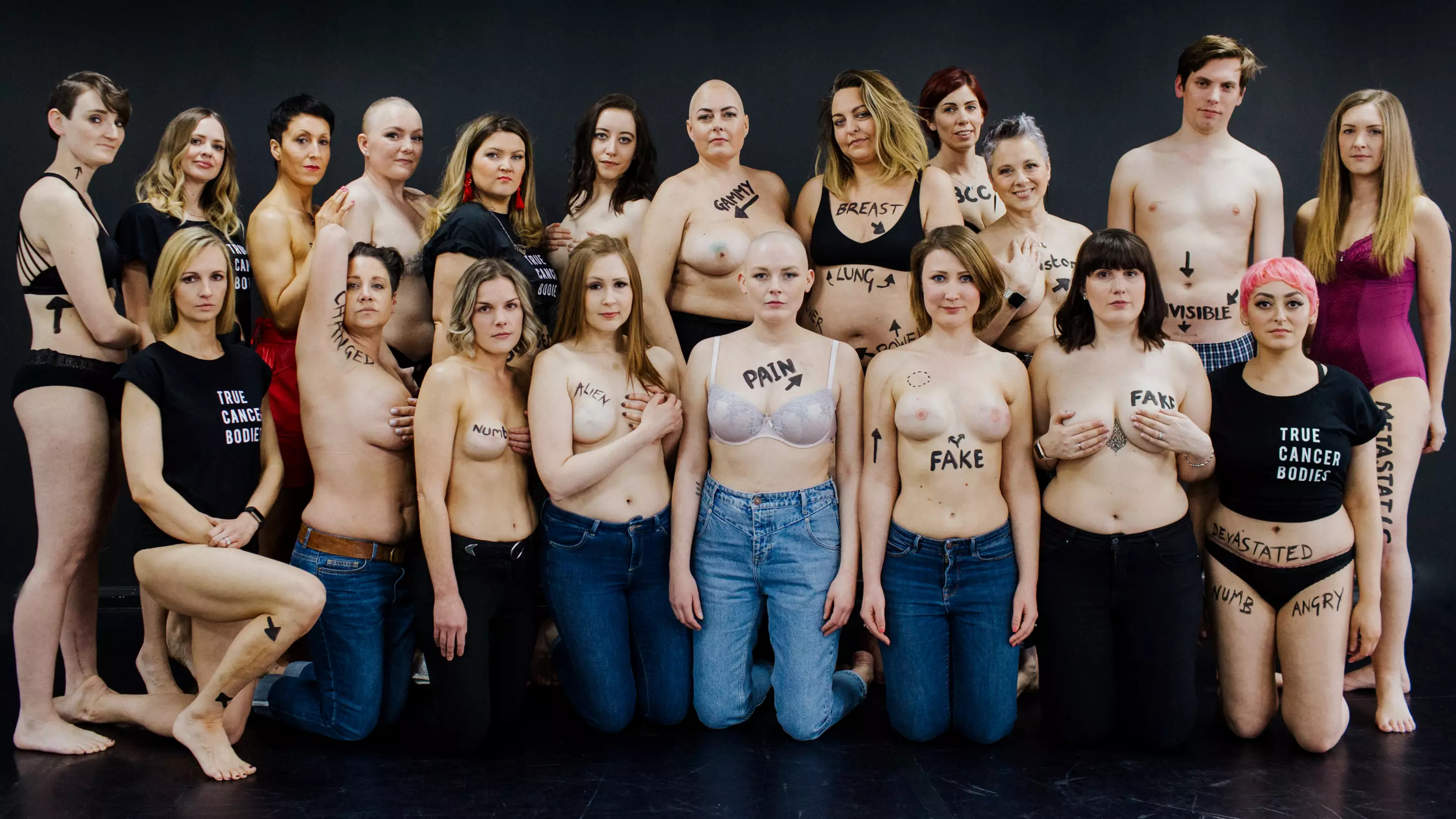 Cancer Survivors Show Off Scars In Powerful Pictures For New Social Media Campaign