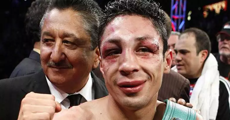 Boxer Loses Right Eye Following Sustained Damage