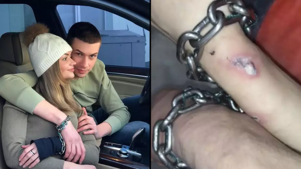 Woman Who Has Chained Herself To Boyfriend For Three Months Has To Be Hospitalised