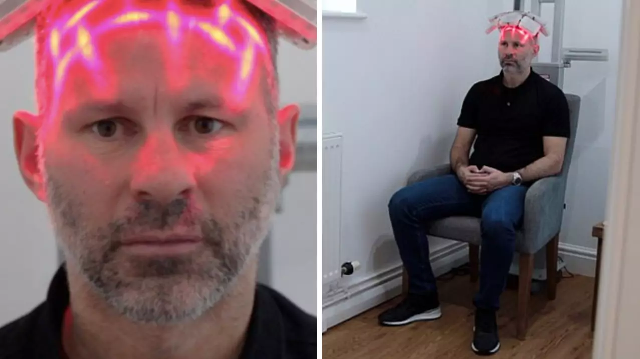 Ryan Giggs Underwent Hair Transplant Due To 'Stress Of Playing For Manchester United'