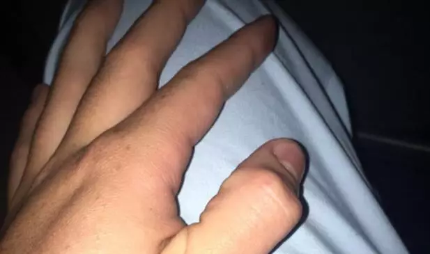 People Are Breaking Their Thumbs In New Inexplicable Internet 'Craze'
