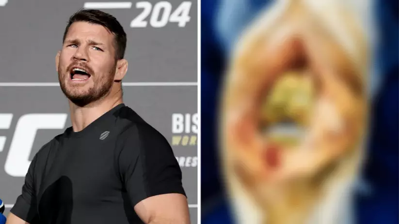 UFC Legend Michael Bisping Shares Gruesome Picture Of Inside A 'Golden Knee' Ahead Of Surgery 