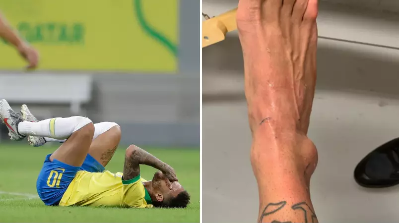 Neymar Shares Picture Of Swollen Ankle Ruling Him Out Of Copa America