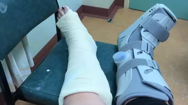 Mum Breaks Both Ankles And Tears Ligaments Attempting TikTok Dance Challenge