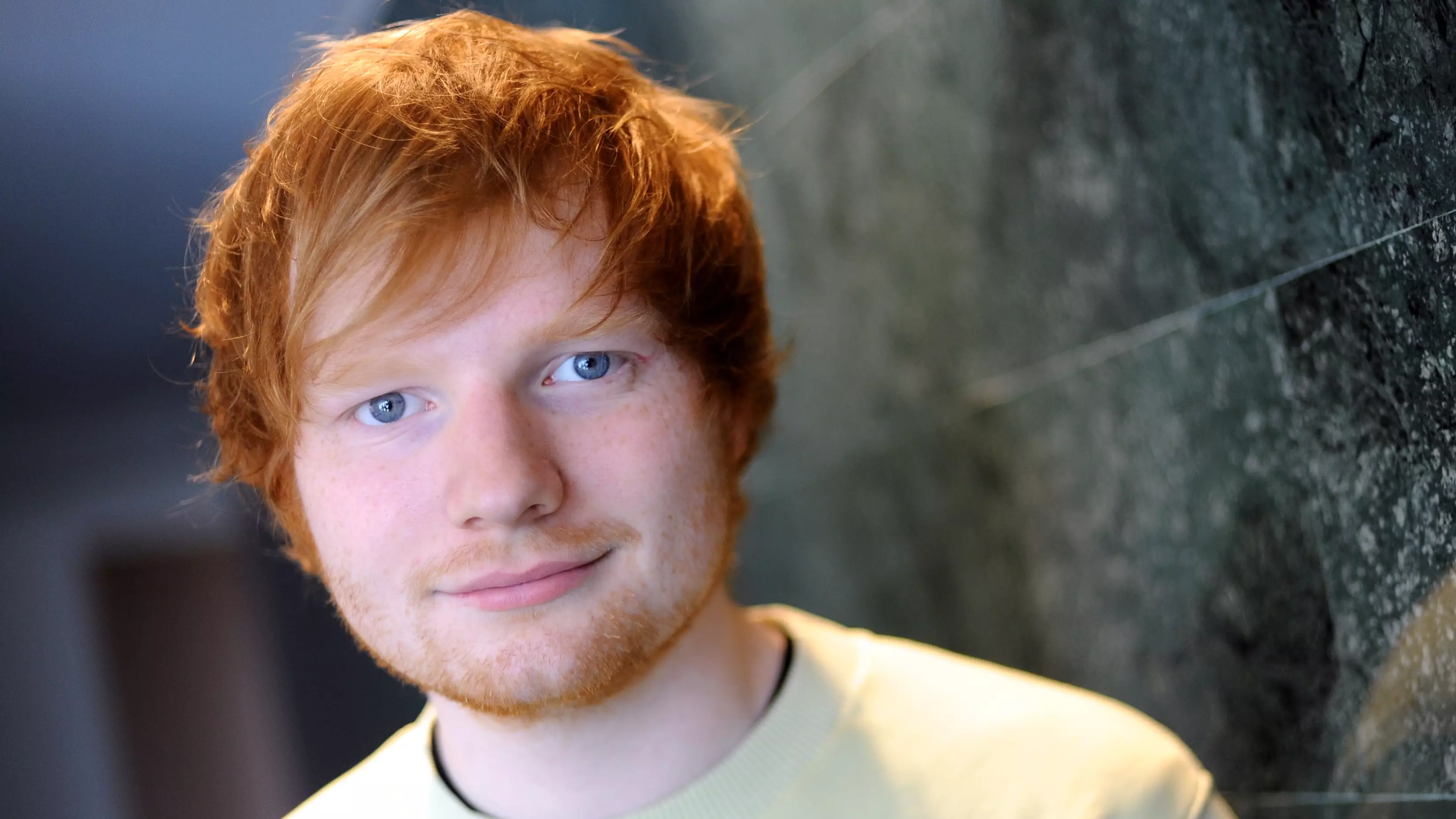 Ed Sheeran Has Injured His Arm After 'Being Hit By A Car'