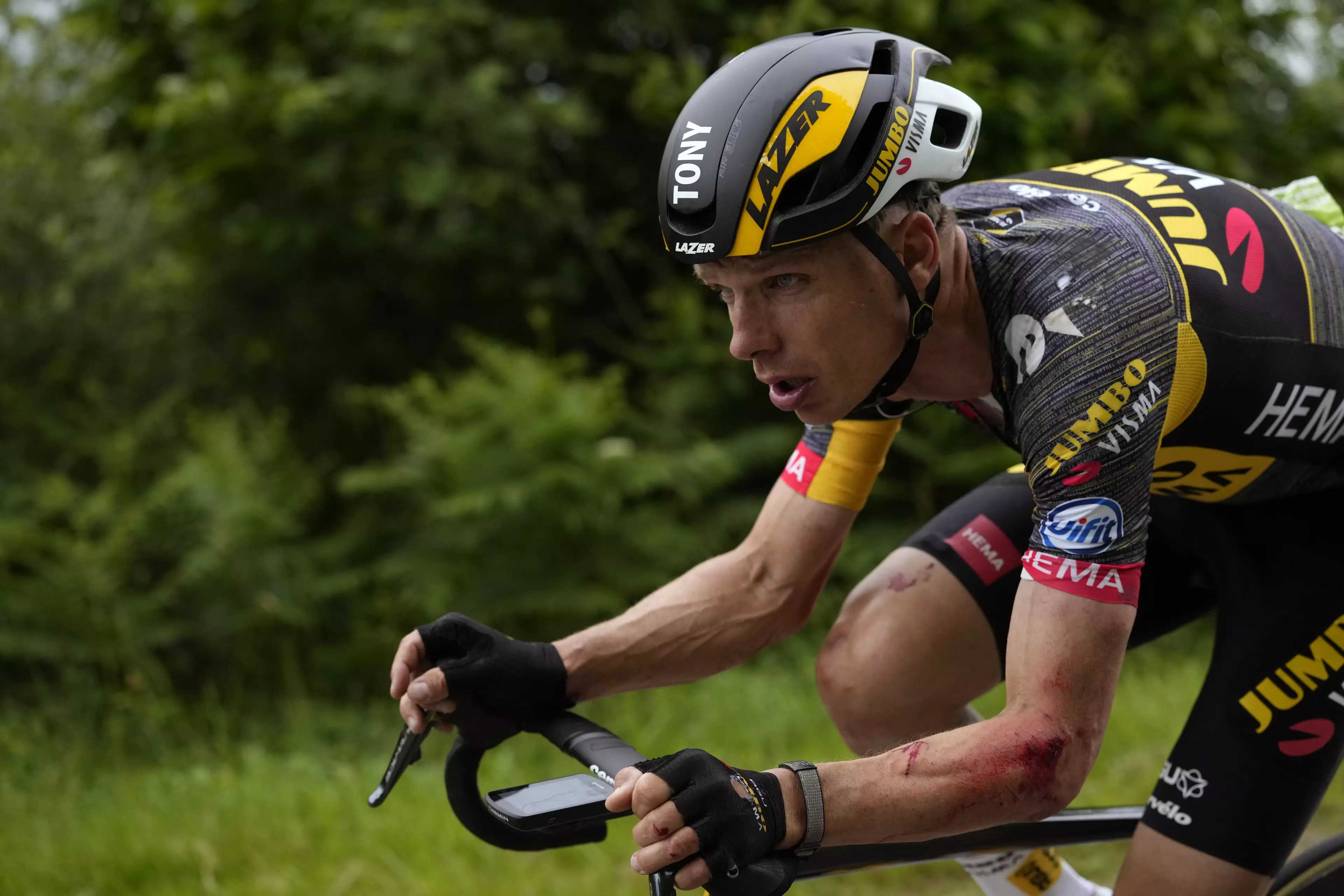 German cyclist Tony Martin rides with injuries to his arm after the incident.