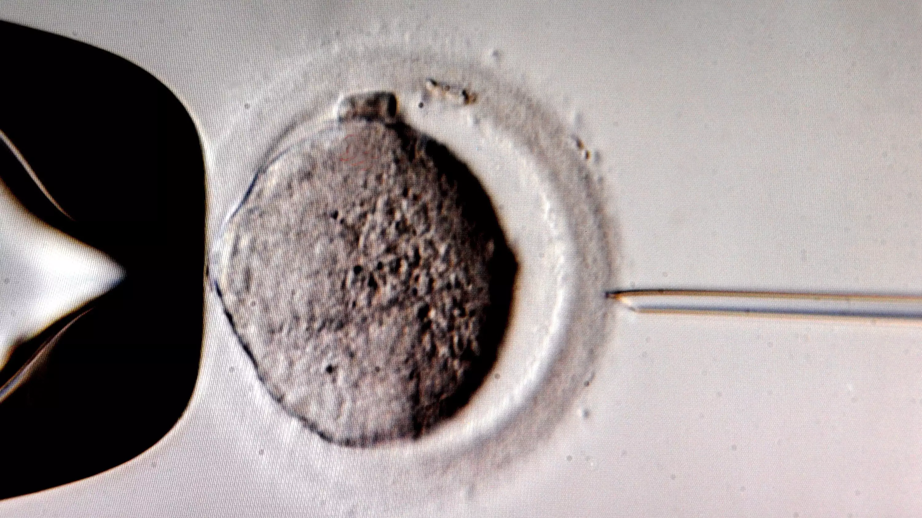 Doctor Accused Of Impregnating Patients With Own Sperm Agrees $10.7m Settlement