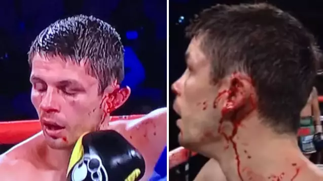 Watch: Boxer's Ear Hangs Off In Vegas Fight