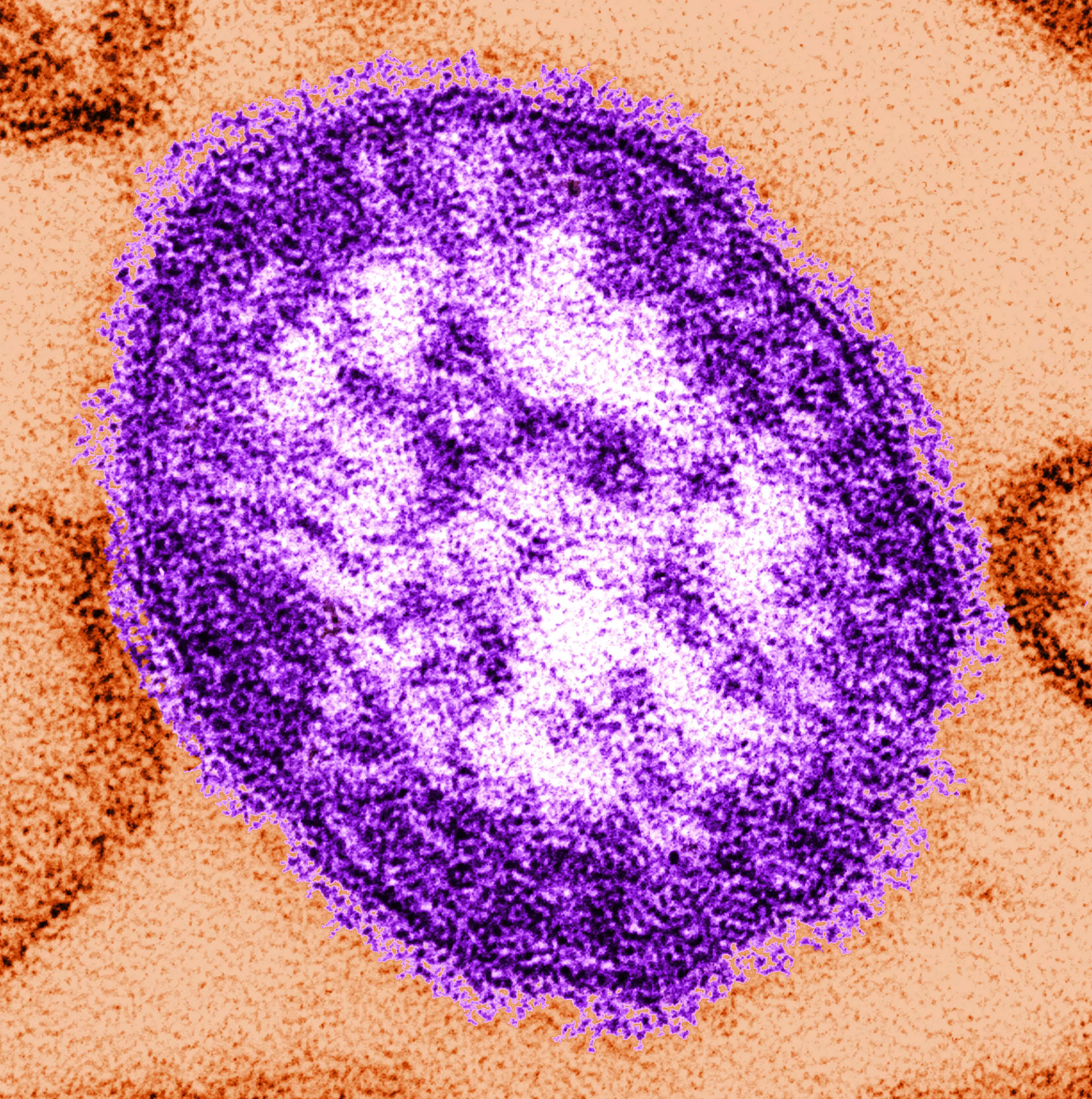Measles virus.