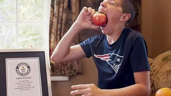 14-Year-Old Boy Breaks Guinness World Record For Having The Largest Mouth