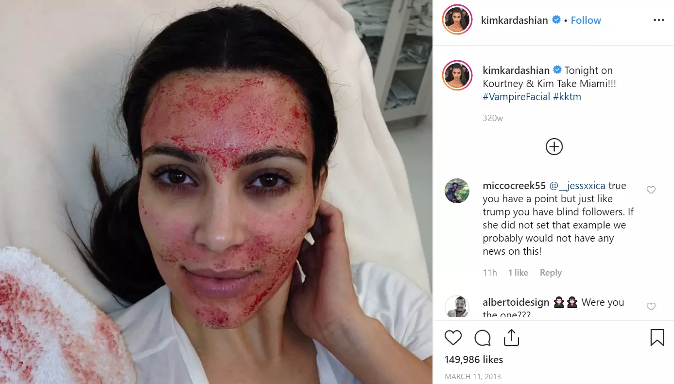 Kim Kardashian brought vampire facials into the public eye.