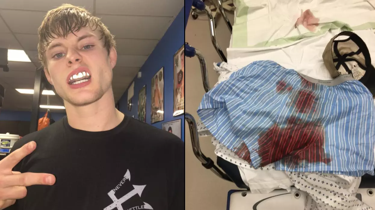UFC Star Bryce Mitchell Gets Testicles 'Tangled' In Electric Drill