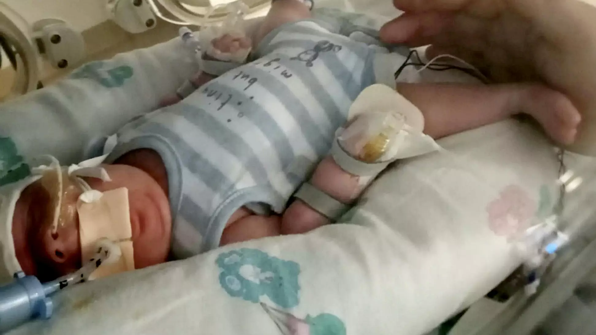 Premature Baby Beat E. coli, Sepsis And Covid In His First Eight Weeks