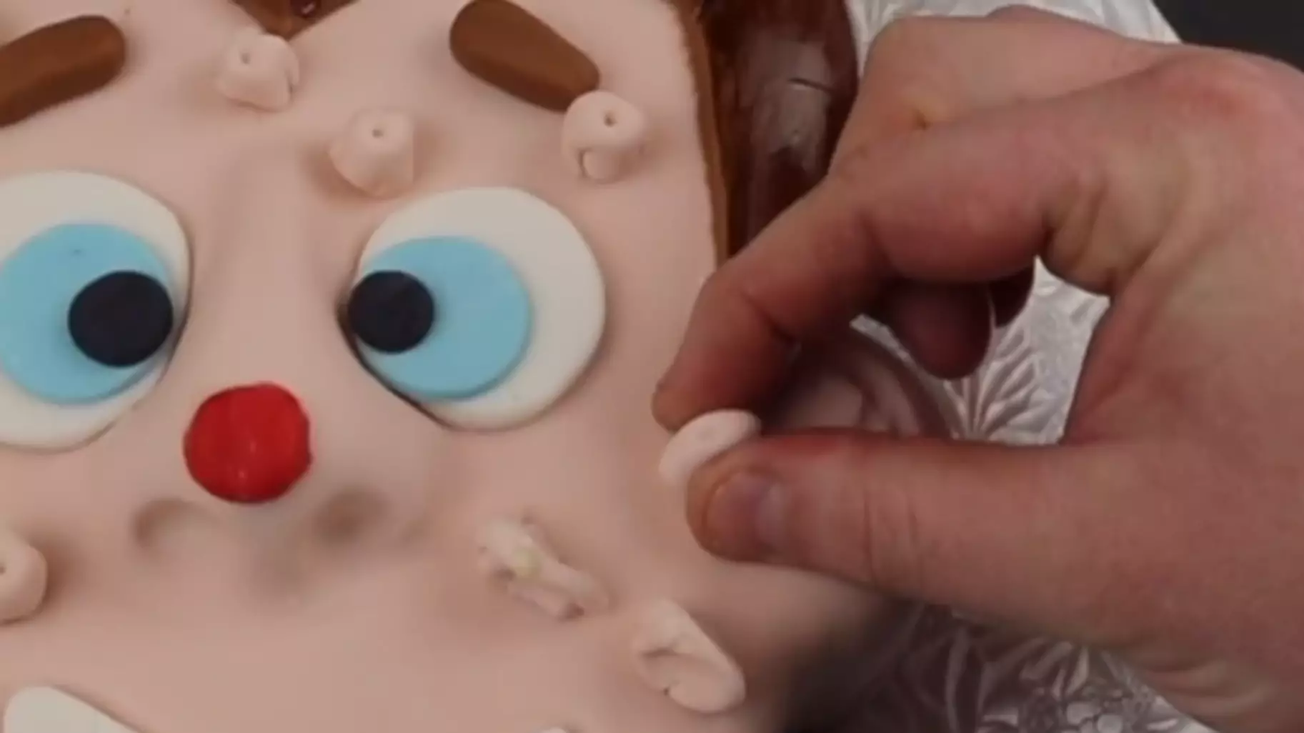 Baker Creates Birthday Cake With Pimples You Can Pop