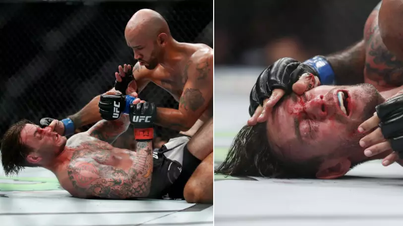 CM Punk Rushed To Hospital After 'Embarrassing' UFC 225 Loss