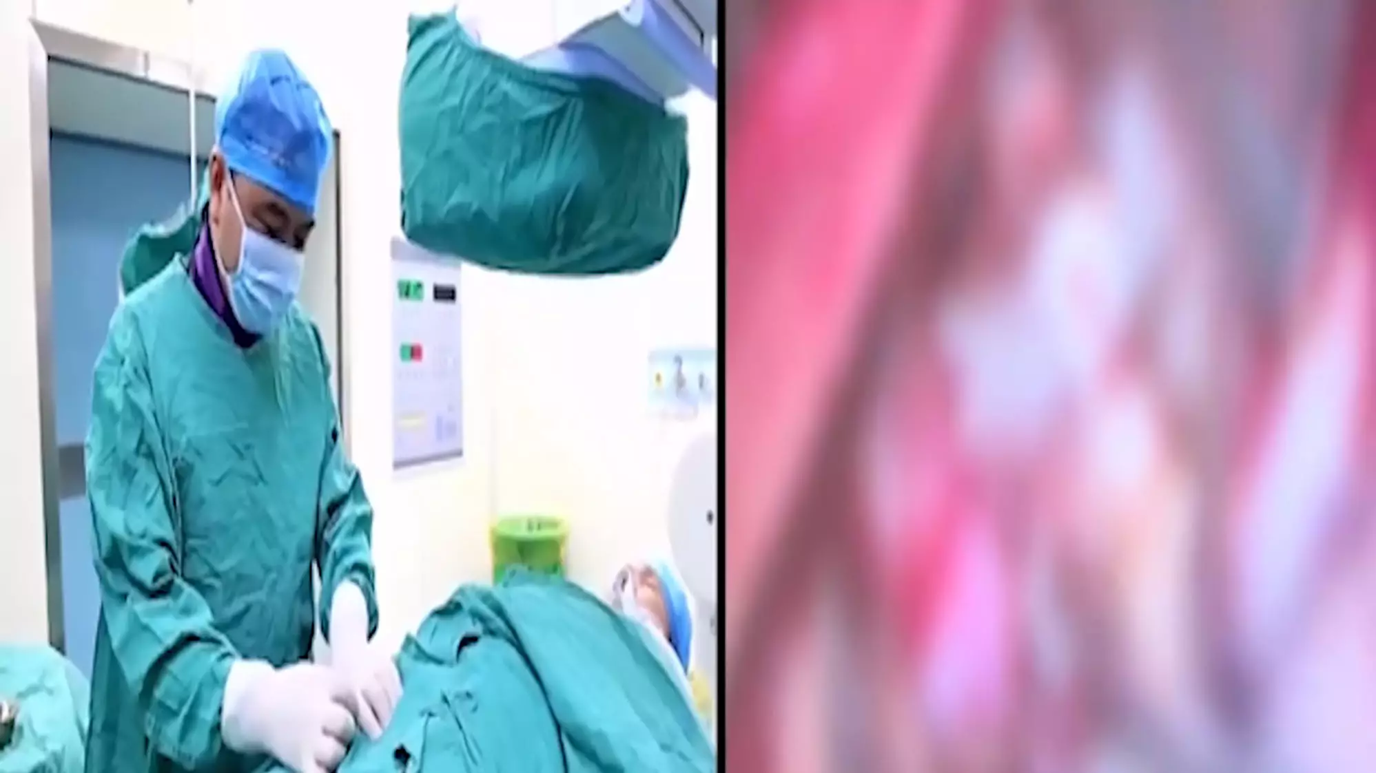 Doctors Remove Four-Inch Tapeworm From Teenager's Brain In The Worst Video Of The Year