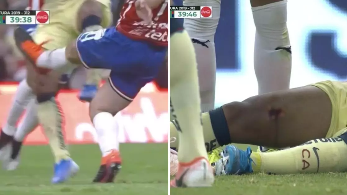 Club America's Giovani Dos Santos Has Chunk Taken Out Of His Leg After Horror Tackle