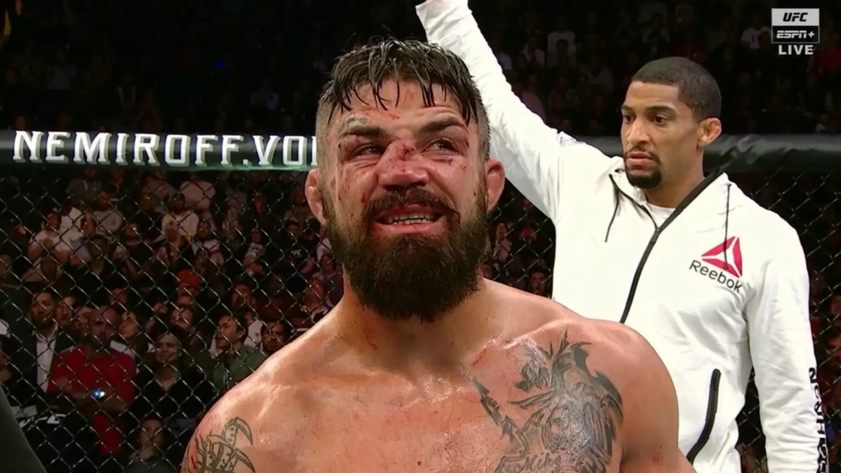 UFC Fighter Mike Perry Suffers Brutal Nose Break Against Vicente Luque