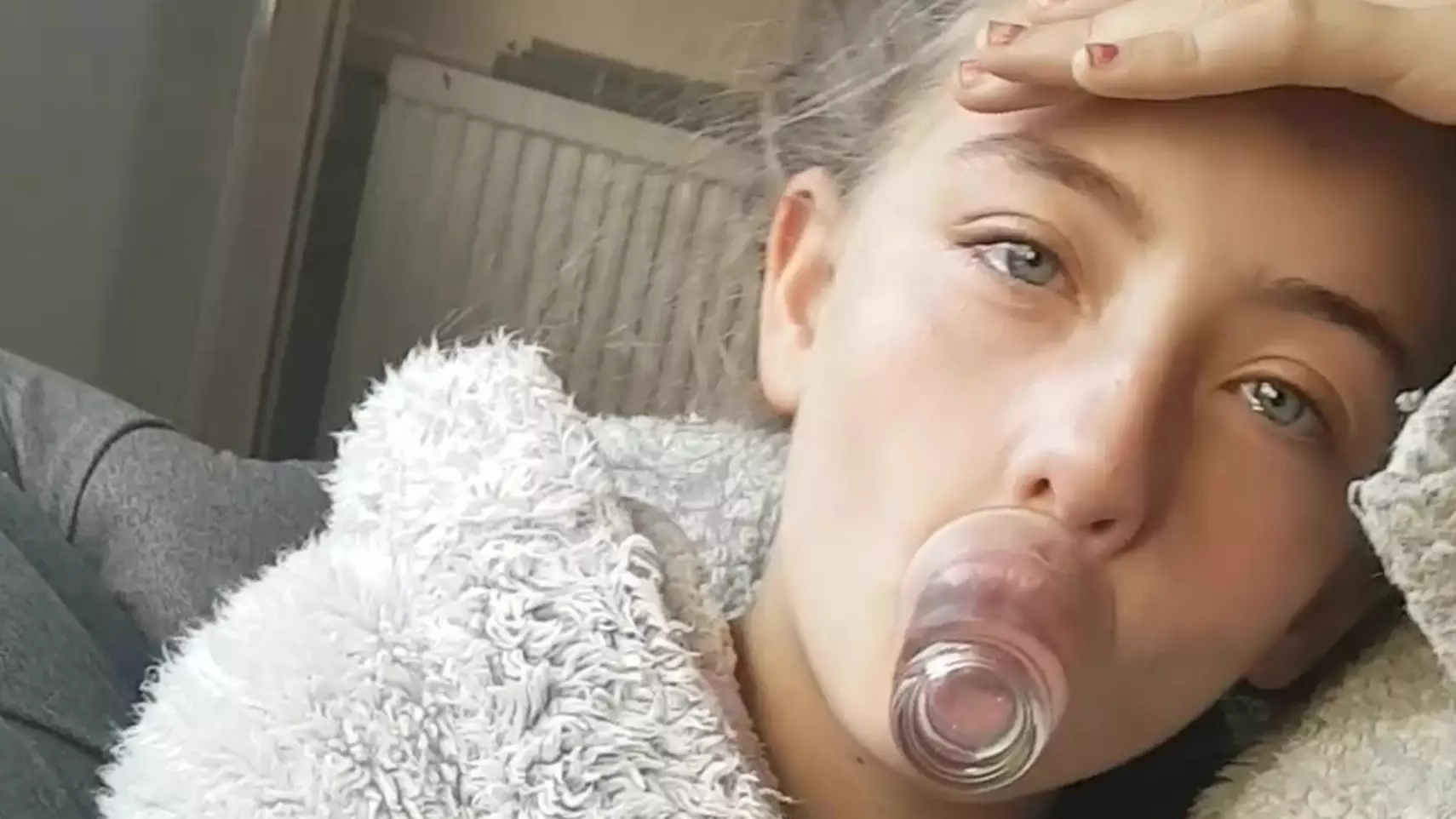 Girl's Lips Inflated For Days After Attempting Kylie Jenner Challenge With Shot Glass