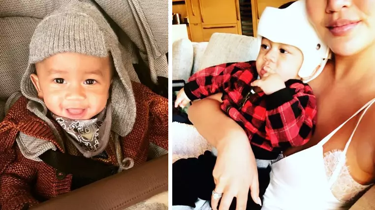 Parents Share Pictures Of Their Babies In Helmets To Support Chrissy Teigen's Son
