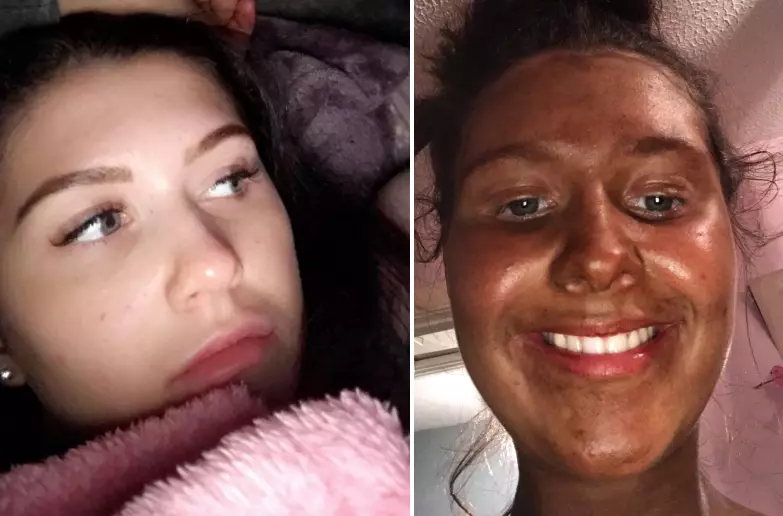 Before and after tanning.