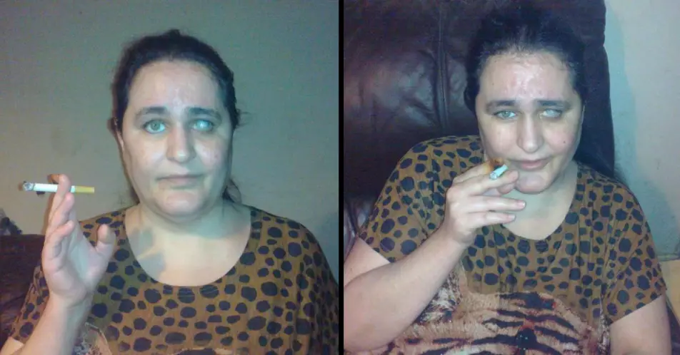 Woman Addicted To Cigarette Butts Eats Eight Every Night Due To Rare Condition