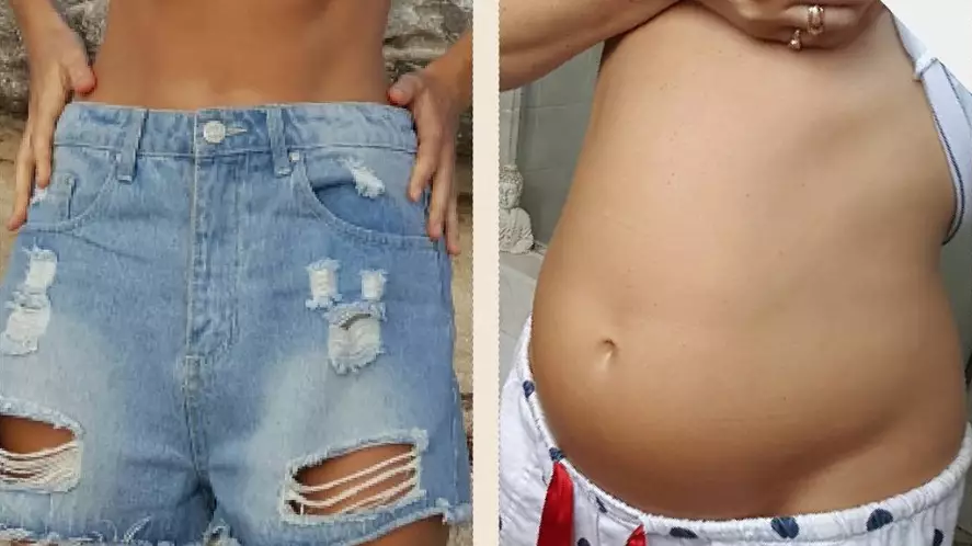 Model Shares Photo That Shows Harsh Reality Of Irritable Bowel Syndrome