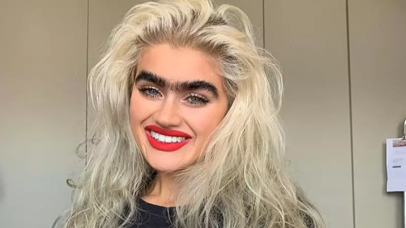 Model With Incredible Monobrow Gets Death Threats For Her Look