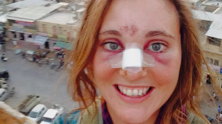 Cow Attacks British Backpacker For Singing Black Eyed Peas Tune