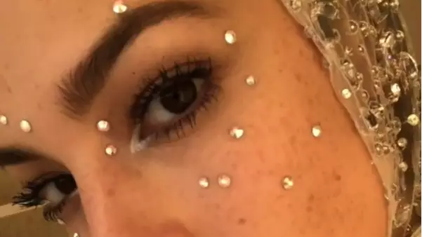Crystal Freckles Are Here - And We're Kind Of Into It