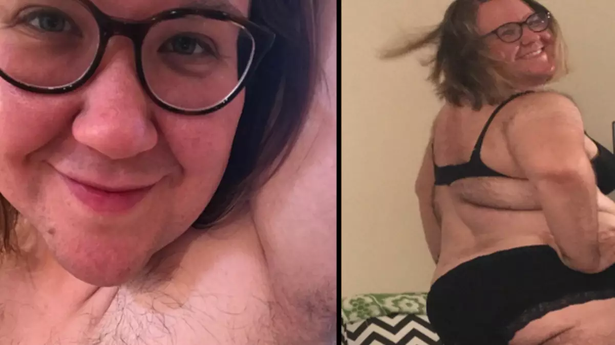 Brave ​PCOS Sufferer Decides To Ditch The Razor And Embrace Her Hairiness