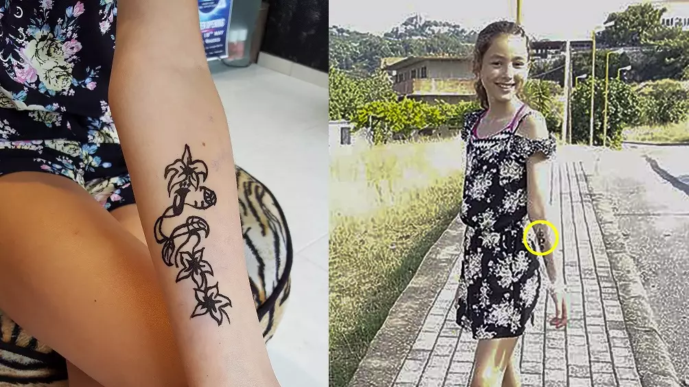 Mum Issues Warning After Daughter Gets Horrific Scar From Henna Tattoo 