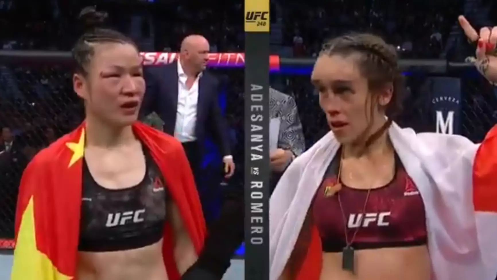 UFC's Joanna Jedrzejczyk Left With Huge Swellings After Zhang Weili Fight 