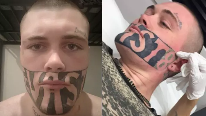 Guy With 'Devast8' Tattooed On His Face Decides To Keep It