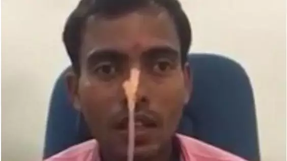 Doctors Struggle To Remove Live Fish From Inside Man's Throat 