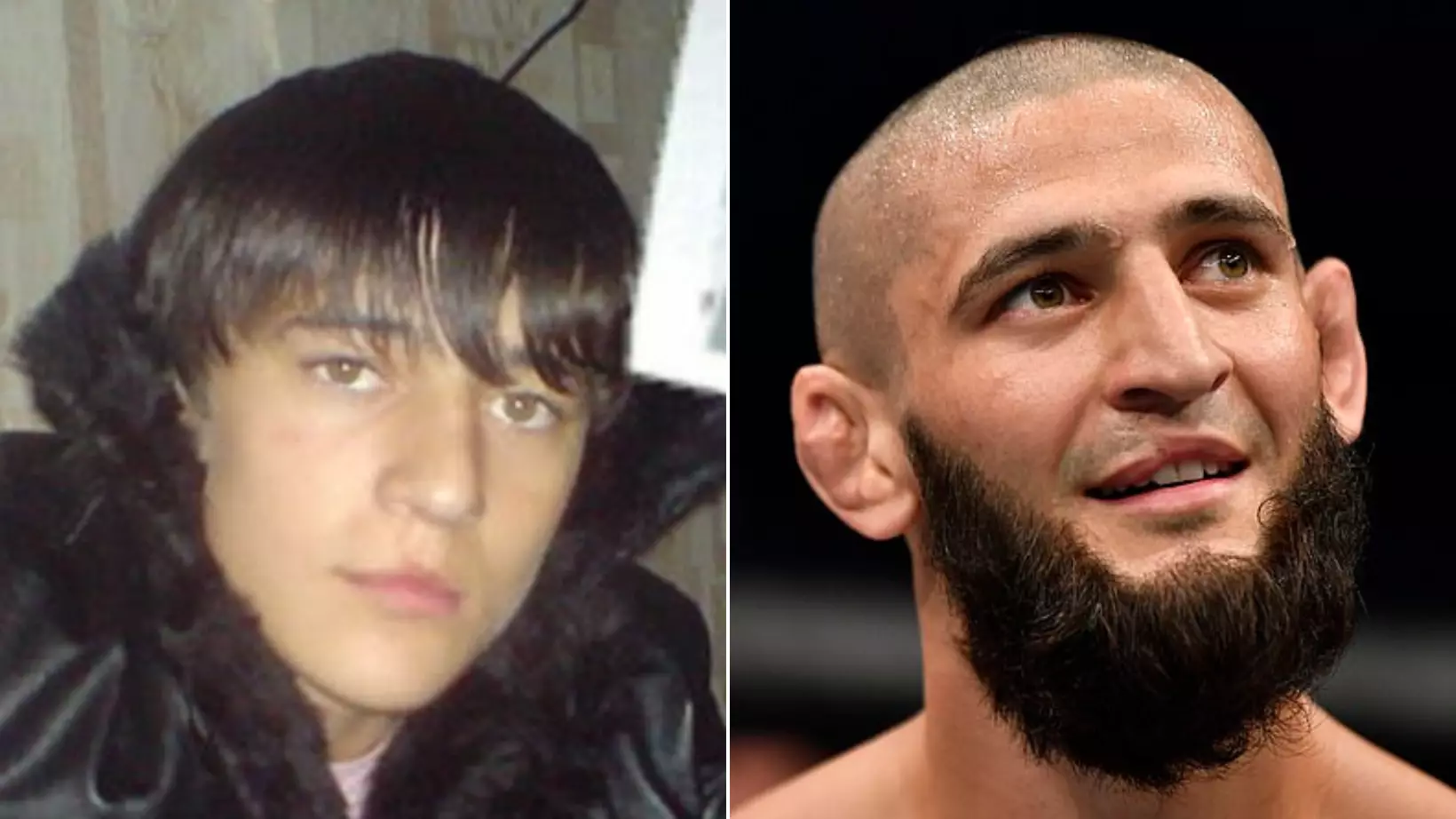 The Gruesome Story Behind Khamzat Chimaev's Lip Scar That Still Causes Him Problems To This Day