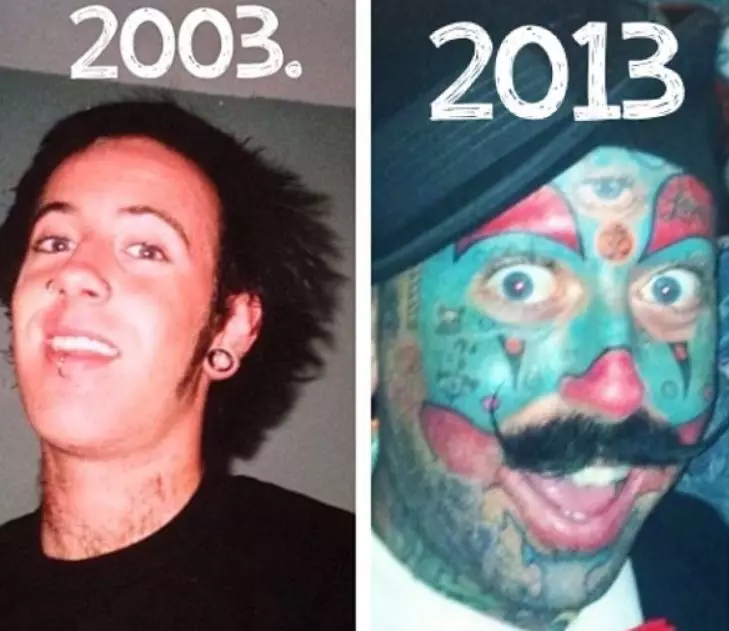 Richie's transformation over the years.